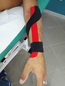 Sofferenza dello scafoide